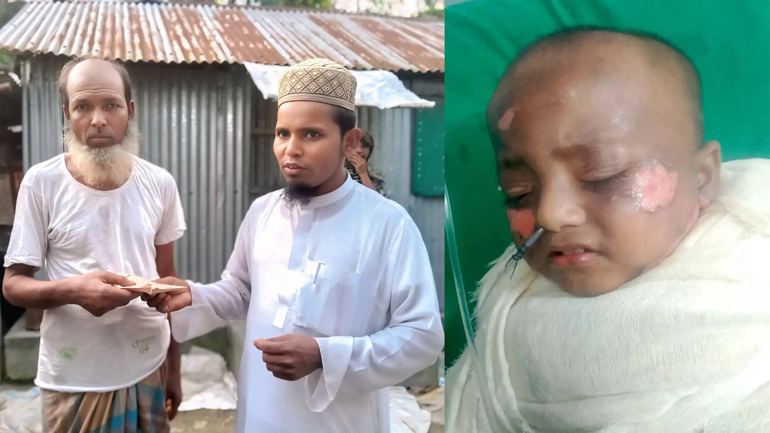 গরম পানিতে দগ্ধ শিশুর মৃত্যু, শোক প্রকাশ ডা. কামাল উদ্দিন সরকারের