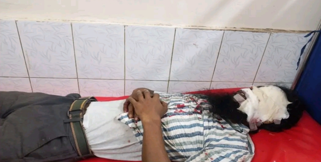 লক্ষ্মীপুরের রায়পুরে চার্জে দিয়ে গেম খেলার সময় মোবাইল বিস্ফোরণ, দুই যুবক আহত